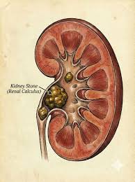 kidney